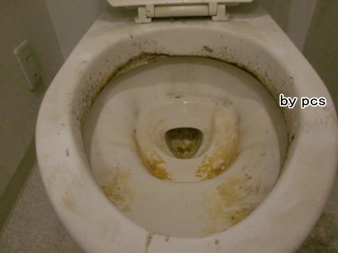 トイレ便器内が尿石で汚れた写真です