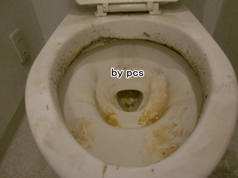 トイレの便器が重度の汚れに