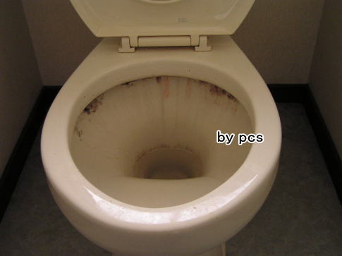 トイレの汚れの写真01