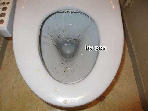汚れたトイレの写真02